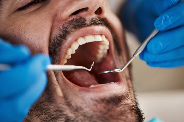 Best Urgent Care for Lost Fillings or Crowns in Chestnut Ridge, NY